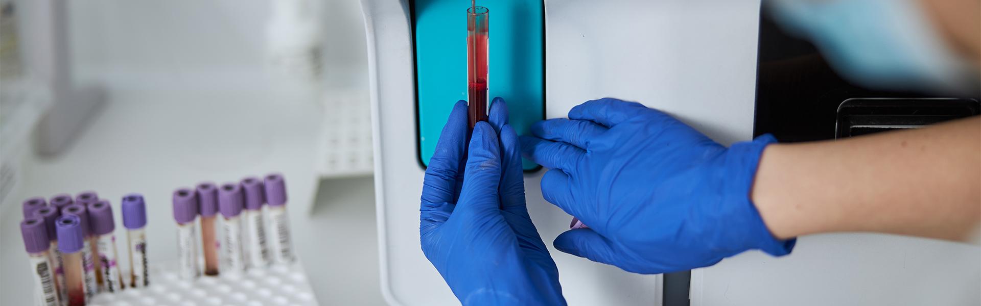 Klinicki slucajevi Hematologija
